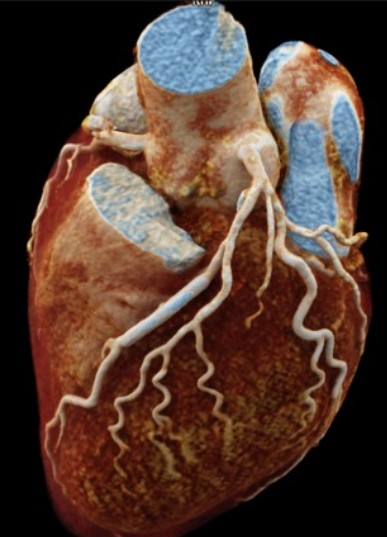 Alternative View Heart Scan DICOM